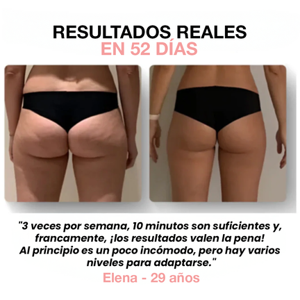 Velure™ - Tu aliado contra la celulitis